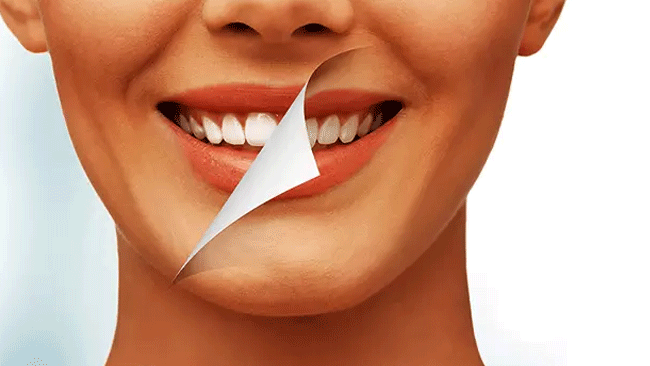 Estetica dentară Estetica dentară