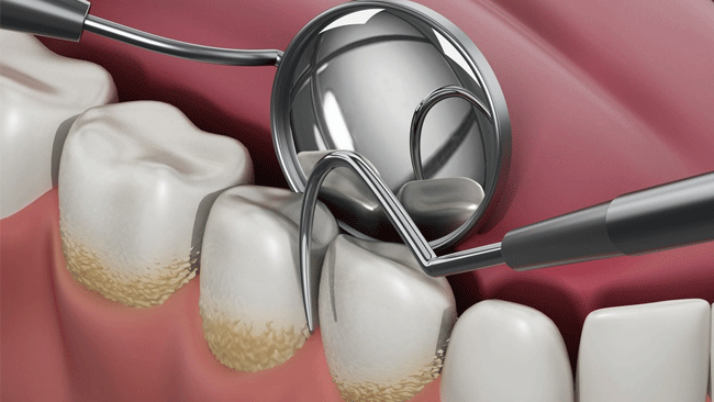 Parodontologie Parodontologie