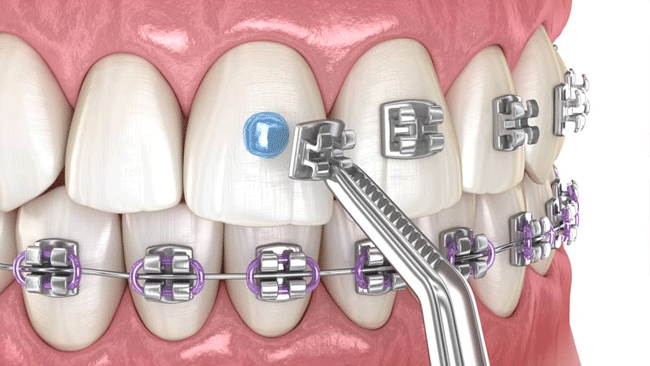 Ortodonție Ortodonție